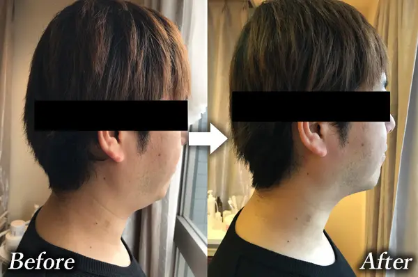 男性の小顔
