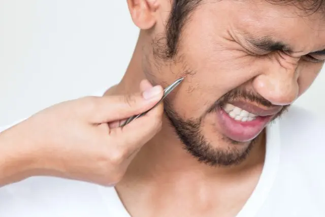 髭抜きは肌荒れを引き起こす!?その危険性や正しい処理方法を解説