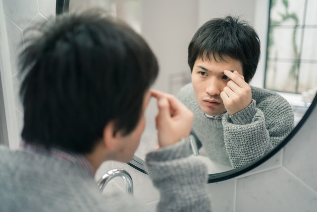 おでこを気にする男性