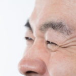 目尻のシワ