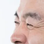 目尻のシワ