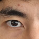 眉間