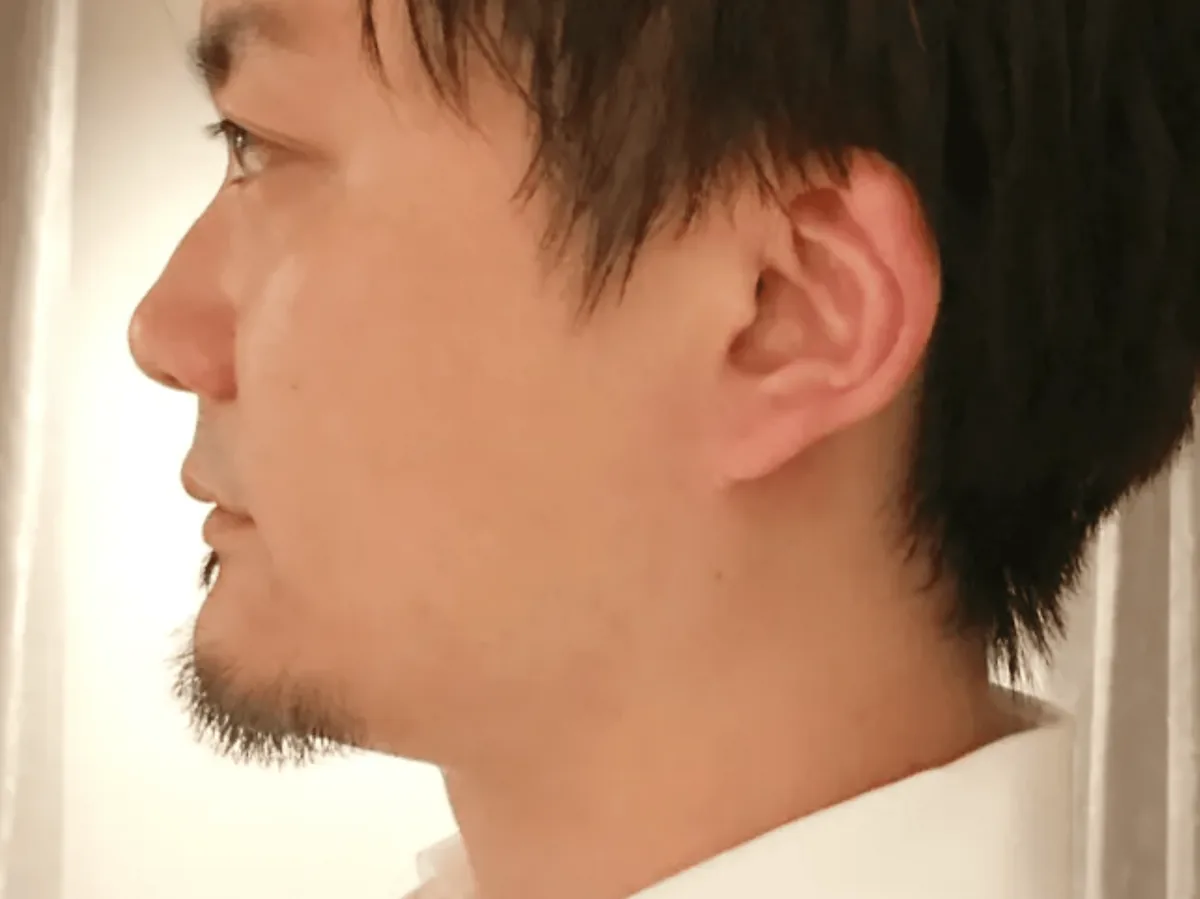 Voice 1-A