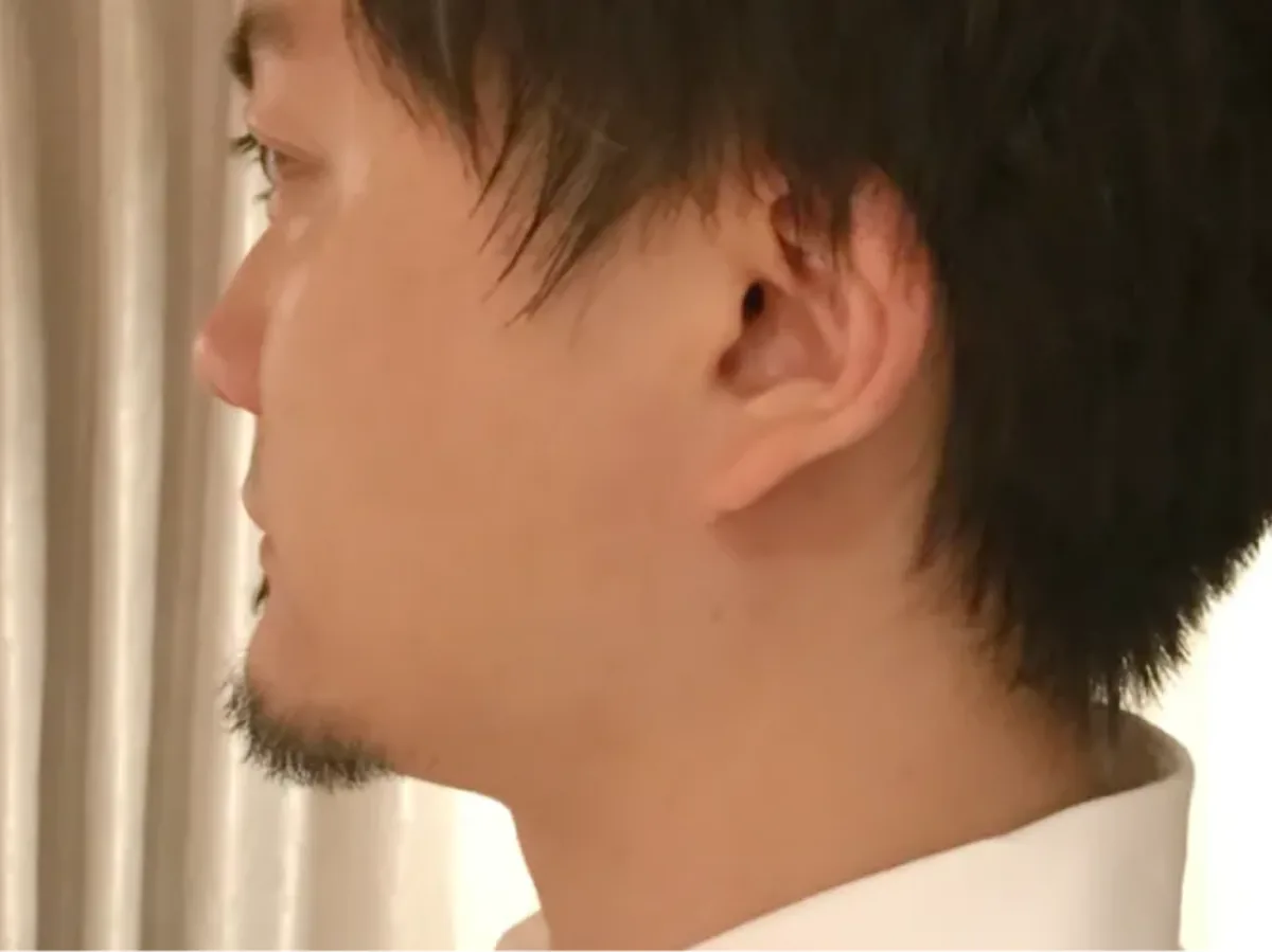 Voice 1-B